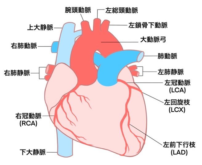 狭心症とは？
