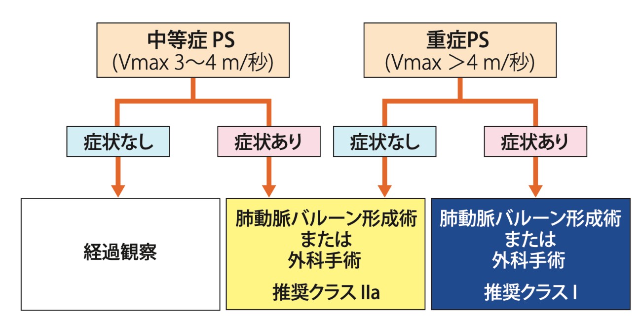 肺動脈狭窄症