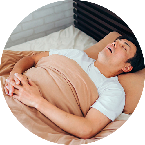 睡眠時無呼吸症候群の治療