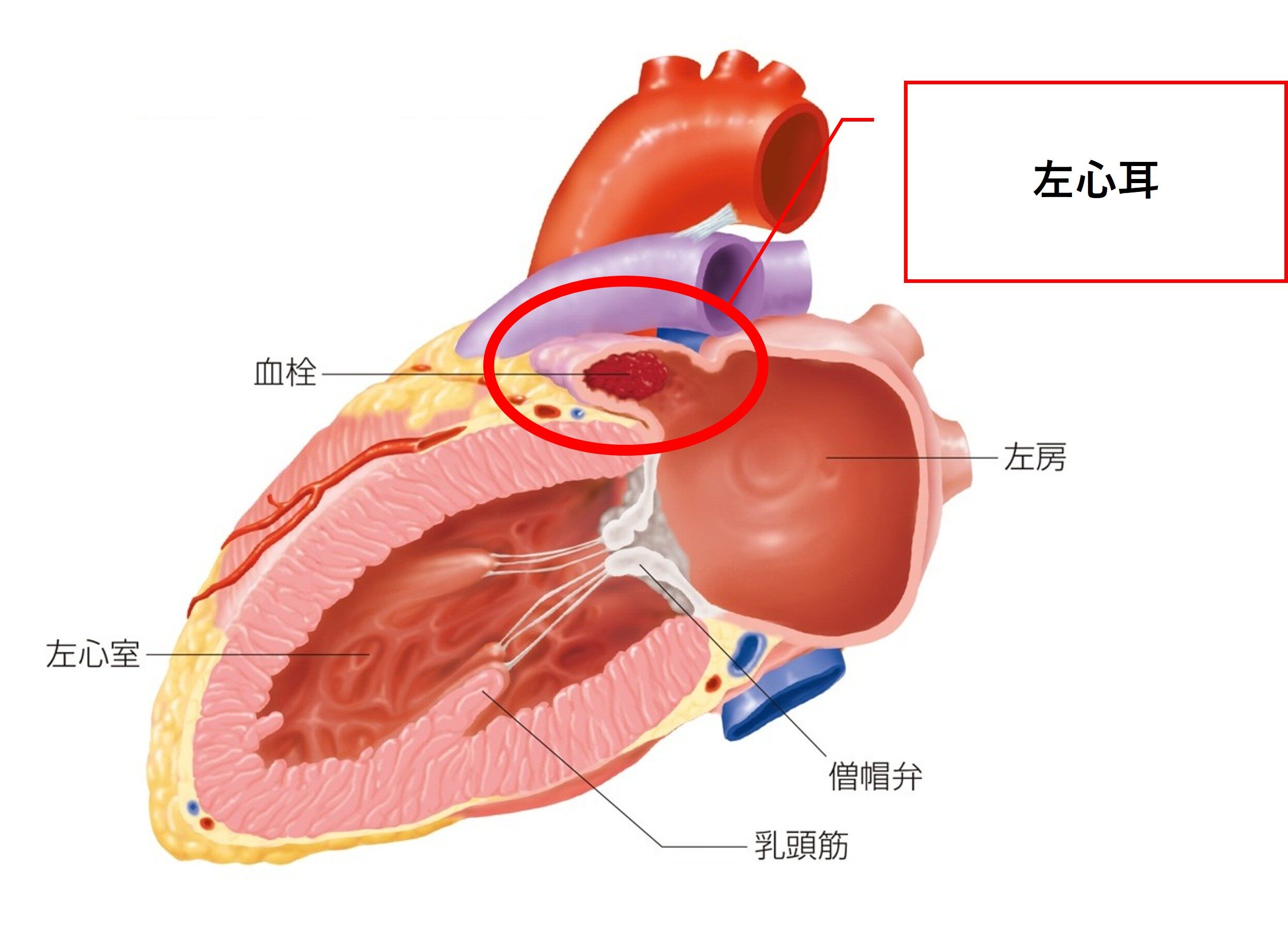 治療しないとどのようなことが起こるか?