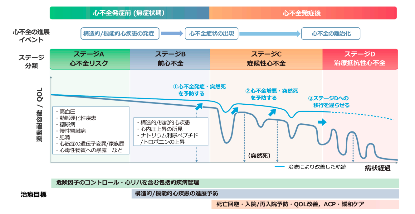 心不全ステージD