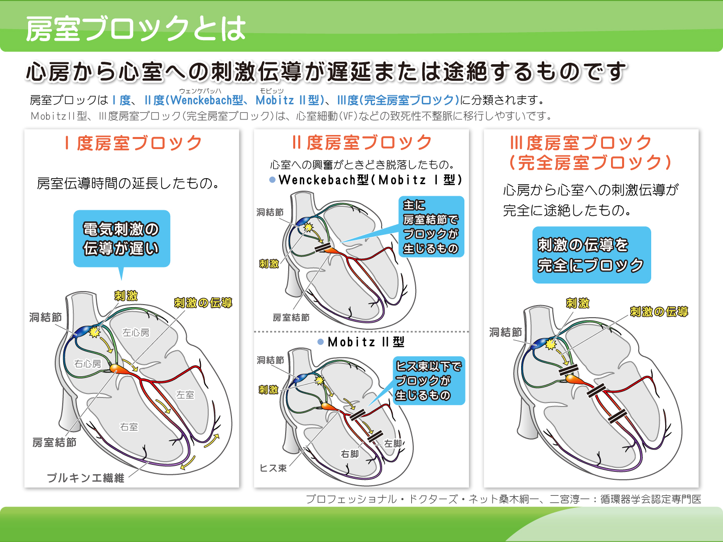 ②房室ブロックとは6